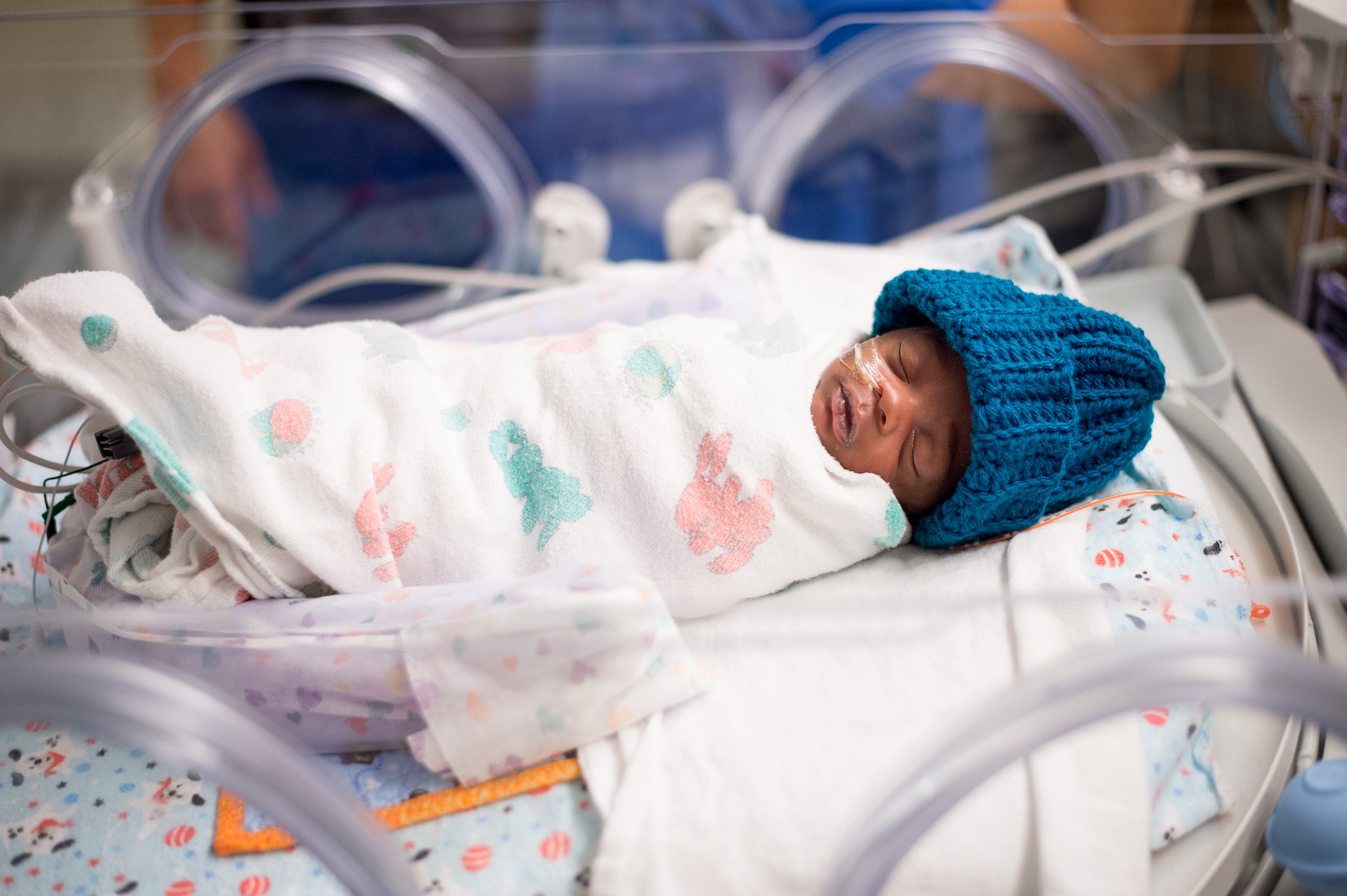 Preterm baby in the NICU